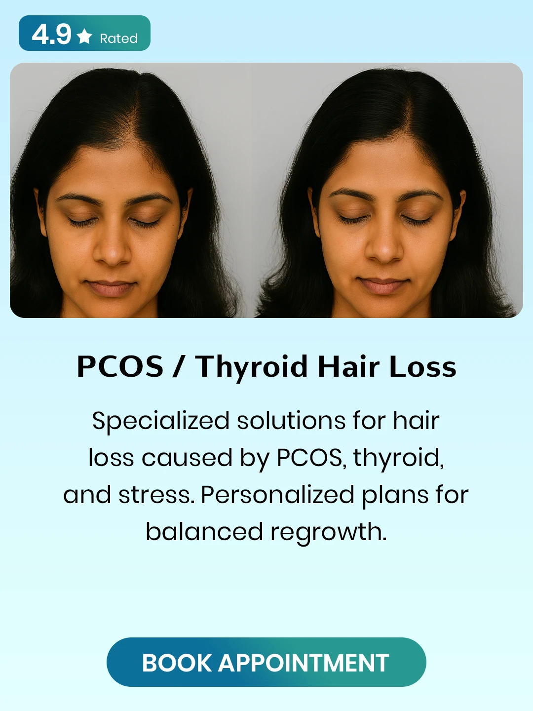 PCOS _ Thyroid Hair Loss